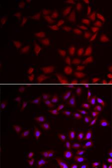 CIRP / CIRBP Antibody - Immunofluorescence analysis of HeLa cells.