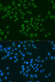 CIRP / CIRBP Antibody - Immunofluorescence analysis of U2OS cells using CIRBP antibody at dilution of 1:100. Blue: DAPI for nuclear staining.