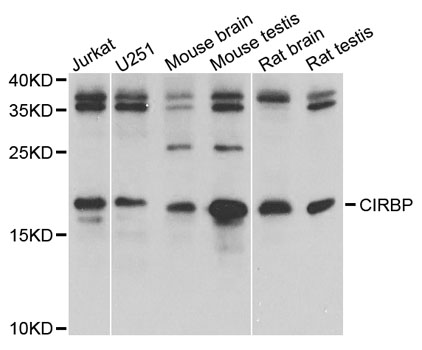 CIRP / CIRBP Antibody - Western blot analysis of extracts of various cell lines, using CIRBP antibody at 1:1000 dilution. The secondary antibody used was an HRP Goat Anti-Rabbit IgG (H+L) at 1:10000 dilution. Lysates were loaded 25ug per lane and 3% nonfat dry milk in TBST was used for blocking. An ECL Kit was used for detection and the exposure time was 1s.
