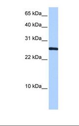 CIRP / CIRBP Antibody - HepG2 cell lysate. Antibody concentration: 0.5 ug/ml. Gel concentration: 15%.  This image was taken for the unconjugated form of this product. Other forms have not been tested.