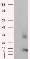 CISD1 Antibody - HEK293T cells were transfected with the pCMV6-ENTRY control (Left lane) or pCMV6-ENTRY CISD1 (Right lane) cDNA for 48 hrs and lysed. Equivalent amounts of cell lysates (5 ug per lane) were separated by SDS-PAGE and immunoblotted with anti-CISD1.