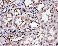 CISD1 Antibody - IHC of paraffin-embedded Kidney tissue using anti-CISD1 mouse monoclonal antibody. (Dilution 1:50).