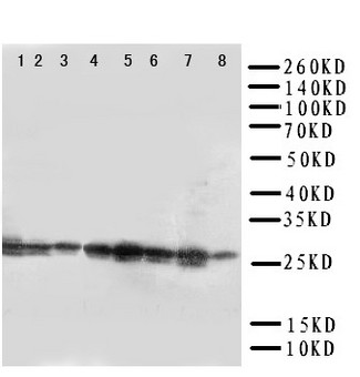 CISH / SOCS Antibody - WB of CISH / SOCS antibody. Lane 1: Rat Liver Tissue Lysate. Lane 2: Rat Kidney Tissue Lysate. Lane 3: Human Placenta Tissue Lysate . Lane 4: A431 Cell Lysate. Lane 5: SMMC Cell Lysate. Lane 6: HELA Cell Lysate. Lane 7: COLO320 Cell Lysate. Lane 8: M231 Cell Lysate.