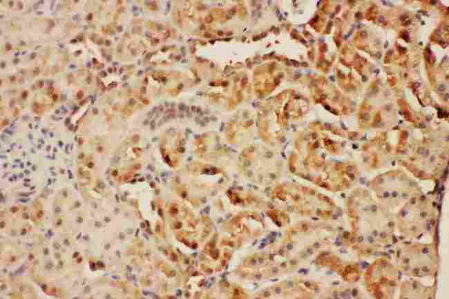 CISH / SOCS Antibody - Anti-CISH antibody, IHC(P): Rat Kidney Tissue