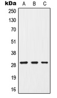 CISH / SOCS Antibody - Western blot analysis of G18 expression in MCF7 (A); mouse brain (B); PC12 (C) whole cell lysates.