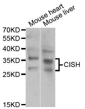 CISH / SOCS Antibody - Western blot analysis of extracts of various cell lines.