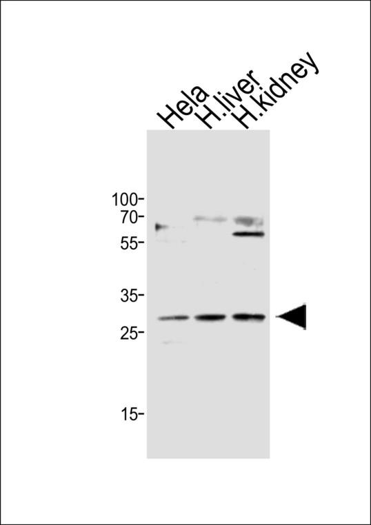CISH / SOCS Antibody - Western blot of lysates from HeLa cell line,human liver,human kidney tissue lysate (from left to right), using CISH Antibody(A1-1587). A1-1587 was diluted at 1:500 at each lane. A goat anti-rabbit IgG H&L (HRP) at 1:10000 dilution was used as the secondary antibody.Lysates at 20 ug per lane.