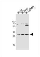 CISH / SOCS Antibody - Western blot of lysates from HeLa cell line,human liver,human kidney tissue lysate (from left to right), using CISH Antibody(A1-1587). A1-1587 was diluted at 1:500 at each lane. A goat anti-rabbit IgG H&L (HRP) at 1:10000 dilution was used as the secondary antibody.Lysates at 20 ug per lane.