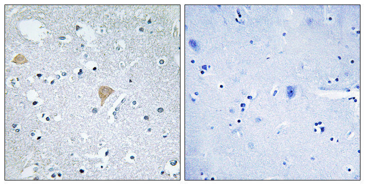 CIT / CRIK / Citron Antibody - Immunohistochemistry analysis of paraffin-embedded human brain tissue, using CTRO Antibody. The picture on the right is blocked with the synthesized peptide.