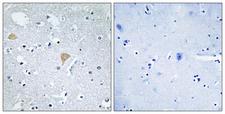 CIT / CRIK / Citron Antibody - Immunohistochemistry analysis of paraffin-embedded human brain tissue, using CTRO Antibody. The picture on the right is blocked with the synthesized peptide.