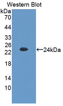 CITED1 Antibody - Western blot of CITED1 antibody.