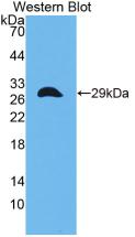 CITED1 Antibody - Western Blot; Sample: Recombinant protein.