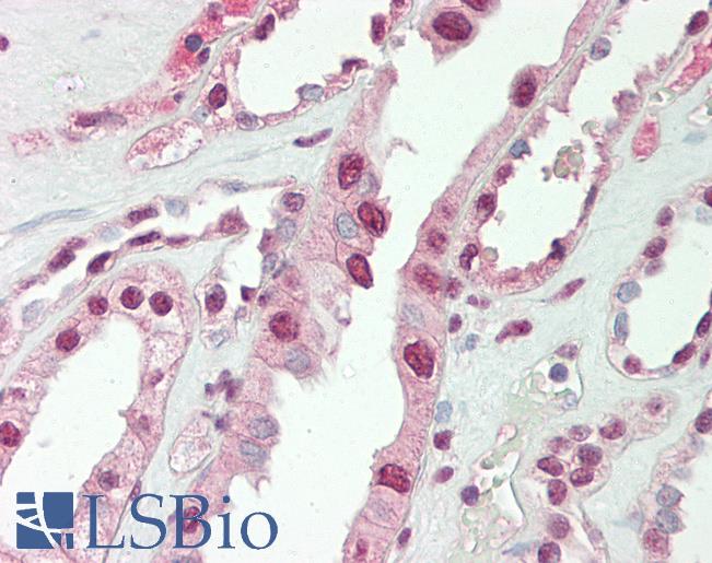 CITED1 Antibody - Human Kidney: Formalin-Fixed, Paraffin-Embedded (FFPE).  This image was taken for the unconjugated form of this product. Other forms have not been tested.
