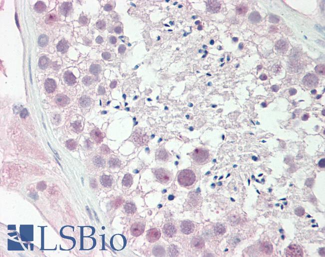 CITED1 Antibody - Human Testis: Formalin-Fixed, Paraffin-Embedded (FFPE).  This image was taken for the unconjugated form of this product. Other forms have not been tested.