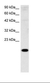 CITED1 Antibody - HepG2 Cell Lysate.  This image was taken for the unconjugated form of this product. Other forms have not been tested.