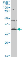 CITED1 Antibody - CITED1 monoclonal antibody (M03), clone 5H6 Western blot of CITED1 expression in A-431.