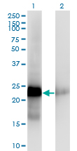 CITED1 Antibody - Western blot of CITED1 expression in transfected 293T cell line by CITED1 monoclonal antibody (M03), clone 5H6.