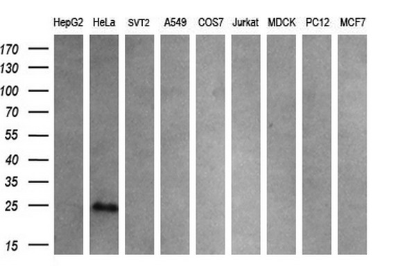 CITED1 Antibody - Western blot analysis of extracts. (35ug) from 9 different cell lines by using anti-CITED1 monoclonal antibody. (HepG2: human; HeLa: human; SVT2: mouse; A549: human; COS7: monkey; Jurkat: human; MDCK: canine;rat; MCF7: human). (1:200)