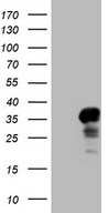 CITED1 Antibody - HEK293T cells were transfected with the pCMV6-ENTRY control (Left lane) or pCMV6-ENTRY CITED1 (Right lane) cDNA for 48 hrs and lysed. Equivalent amounts of cell lysates (5 ug per lane) were separated by SDS-PAGE and immunoblotted with anti-CITED1.