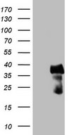 CITED1 Antibody - HEK293T cells were transfected with the pCMV6-ENTRY control. (Left lane) or pCMV6-ENTRY CITED1. (Right lane) cDNA for 48 hrs and lysed. Equivalent amounts of cell lysates. (5 ug per lane) were separated by SDS-PAGE and immunoblotted with anti-CITED1.