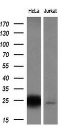 CITED1 Antibody - Western blot analysis of extracts. (10ug) from 2 different cell lines by using anti-CITED1 monoclonal antibody. (1:200)