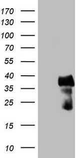 CITED1 Antibody - HEK293T cells were transfected with the pCMV6-ENTRY control (Left lane) or pCMV6-ENTRY CITED1 (Right lane) cDNA for 48 hrs and lysed. Equivalent amounts of cell lysates (5 ug per lane) were separated by SDS-PAGE and immunoblotted with anti-CITED1.