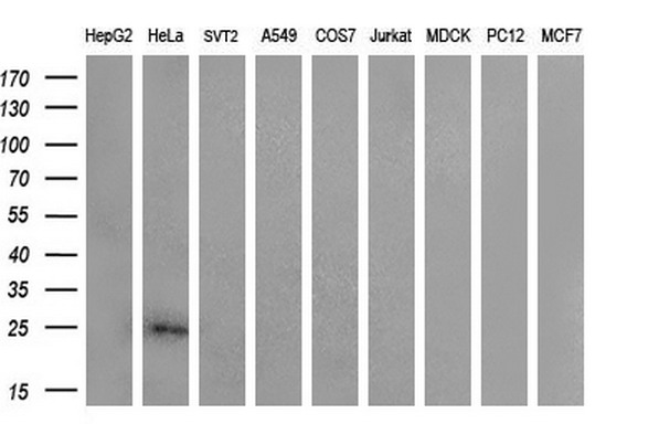 CITED1 Antibody - Western blot analysis of extracts. (35ug) from 9 different cell lines by using anti-CITED1 monoclonal antibody. (HepG2: human; HeLa: human; SVT2: mouse; A549: human; COS7: monkey; Jurkat: human; MDCK: canine;rat; MCF7: human). (1:200)