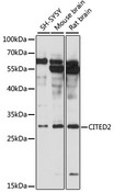 CITED2 Antibody - Western blot analysis of extracts of various cell lines, using CITED2 antibody at 1:3000 dilution. The secondary antibody used was an HRP Goat Anti-Rabbit IgG (H+L) at 1:10000 dilution. Lysates were loaded 25ug per lane and 3% nonfat dry milk in TBST was used for blocking. An ECL Kit was used for detection and the exposure time was 10s.