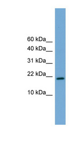 CITED4 Antibody - CITED4 antibody Western blot of Mouse Heart lysate. This image was taken for the unconjugated form of this product. Other forms have not been tested.