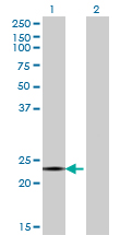 CITED4 Antibody - Western blot of CITED4 expression in transfected 293T cell line by CITED4 monoclonal antibody (M08), clone 4F6.
