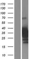 CITED4 Protein - Western validation with an anti-DDK antibody * L: Control HEK293 lysate R: Over-expression lysate