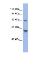 CIZ1 Antibody - CIZ1 antibody Western blot of HT1080 cell lysate. This image was taken for the unconjugated form of this product. Other forms have not been tested.