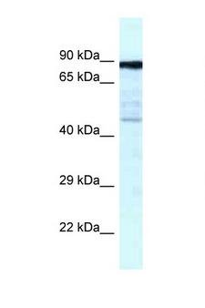 CKAP2 Antibody - CKAP2 antibody Western blot of Fetal Lung lysate. Antibody concentration 1 ug/ml.  This image was taken for the unconjugated form of this product. Other forms have not been tested.