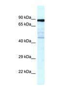 CKAP2 Antibody - CKAP2 antibody Western blot of Fetal Lung lysate. Antibody concentration 1 ug/ml.  This image was taken for the unconjugated form of this product. Other forms have not been tested.