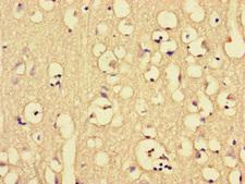 CKAP2L Antibody - Immunohistochemistry of paraffin-embedded human brain tissue at dilution of 1:100