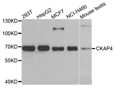 CKAP4 Antibody - Western blot analysis of extracts of various cells.