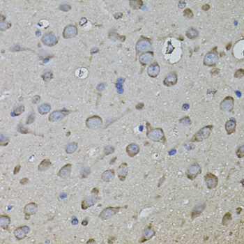 CKAP4 Antibody - Immunohistochemistry of paraffin-embedded rat brain tissue.