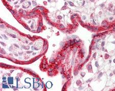 CKAP4 Antibody - Human Placenta: Formalin-Fixed, Paraffin-Embedded (FFPE).  This image was taken for the unconjugated form of this product. Other forms have not been tested.