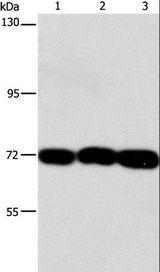 CKAP4 Antibody - Western blot analysis of 293T, hepG2 and A549 cell, using CKAP4 Polyclonal Antibody at dilution of 1:1250.