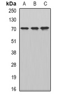 CKAP4 Antibody - Western blot analysis of CKAP4 expression in HepG2 (A); MCF7 (B); mouse testis (C) whole cell lysates.