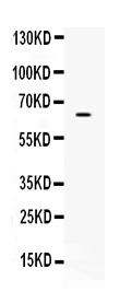 CKAP4 Antibody - Western blot analysis of CKAP4 expression in mouse brain extract. CKAP4 at 66KD was detected using rabbit anti- CKAP4 Antigen Affinity purified polyclonal antibody