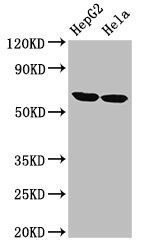 CKAP4 Antibody - Positive Western Blot detected in HepG2 whole cell lysate, Hela whole cell lysate. All lanes: CKAP4 antibody at 2.7 µg/ml Secondary Goat polyclonal to rabbit IgG at 1/50000 dilution. Predicted band size: 67 KDa. Observed band size: 67 KDa