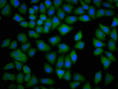 CKAP4 Antibody - Immunofluorescence staining of Hela cells with CKAP4 Antibody at 1:133, counter-stained with DAPI. The cells were fixed in 4% formaldehyde, permeabilized using 0.2% Triton X-100 and blocked in 10% normal Goat Serum. The cells were then incubated with the antibody overnight at 4°C. The secondary antibody was Alexa Fluor 488-congugated AffiniPure Goat Anti-Rabbit IgG(H+L).