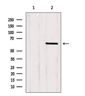 CKAP4 Antibody - Western blot analysis of extracts of HepG2 cells using CKAP4 antibody. Lane 1 was treated with the blocking peptide.