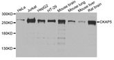 CKAP5 / ch-TOG Antibody - Western blot analysis of extracts of various cells.