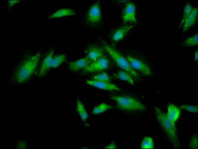 CKAP5 / ch-TOG Antibody - Immunofluorescence staining of Hela cells at a dilution of 1:133, counter-stained with DAPI. The cells were fixed in 4% formaldehyde, permeabilized using 0.2% Triton X-100 and blocked in 10% normal Goat Serum. The cells were then incubated with the antibody overnight at 4°C.The secondary antibody was Alexa Fluor 488-congugated AffiniPure Goat Anti-Rabbit IgG (H+L) .