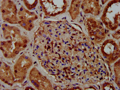 CKAP5 / ch-TOG Antibody - Immunohistochemistry image at a dilution of 1:400 and staining in paraffin-embedded human kidney tissue performed on a Leica BondTM system. After dewaxing and hydration, antigen retrieval was mediated by high pressure in a citrate buffer (pH 6.0) . Section was blocked with 10% normal goat serum 30min at RT. Then primary antibody (1% BSA) was incubated at 4 °C overnight. The primary is detected by a biotinylated secondary antibody and visualized using an HRP conjugated SP system.