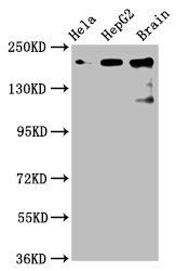 CKAP5 / ch-TOG Antibody - Positive Western Blot detected in Hela whole cell lysate, HepG2 whole cell lysate, Rat brain tissue. All lanes: CKAP5 antibody at 6 µg/ml Secondary Goat polyclonal to rabbit IgG at 1/50000 dilution. Predicted band size: 226, 219, 227 KDa. Observed band size: 226 KDa