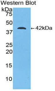 CKB / Creatine Kinase BB Antibody - Western blot of recombinant CKB / Creatine Kinase BB.  This image was taken for the unconjugated form of this product. Other forms have not been tested.