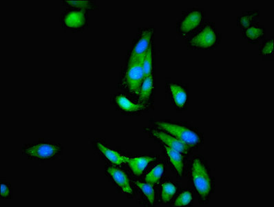 CKB / Creatine Kinase BB Antibody - Immunofluorescent analysis of Hela cells using CKB Antibody at dilution of 1:100 and Alexa Fluor 488-congugated AffiniPure Goat Anti-Rabbit IgG(H+L)